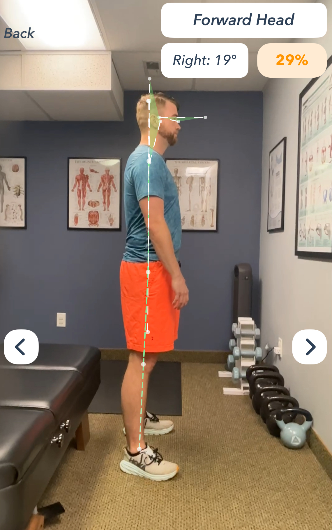 Forward head posture example